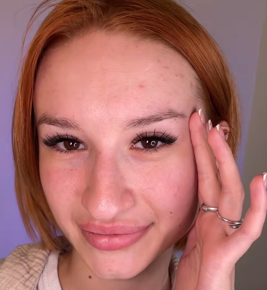  7/10